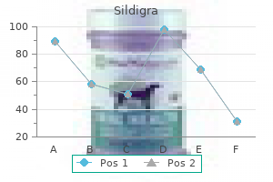 cheap generic sildigra uk