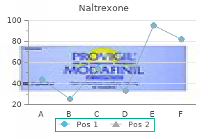 order generic naltrexone from india