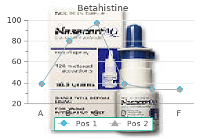 purchase generic betahistine line