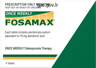fosamax 70 mg mastercard