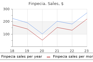order cheap finpecia line