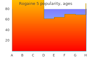 buy generic rogaine 5 60 ml online