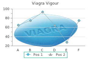 discount generic viagra vigour uk