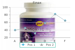 finax 1 mg on line