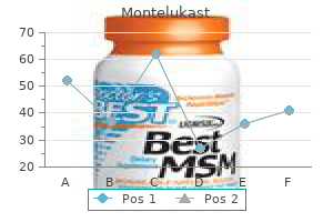 cheap montelukast 5mg without a prescription
